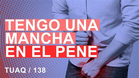 Manchas oscuras en el pene: causas